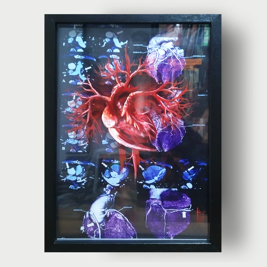 Quadro Anatomia: Pintura original Coração com artérias Fundo Tomagrafia