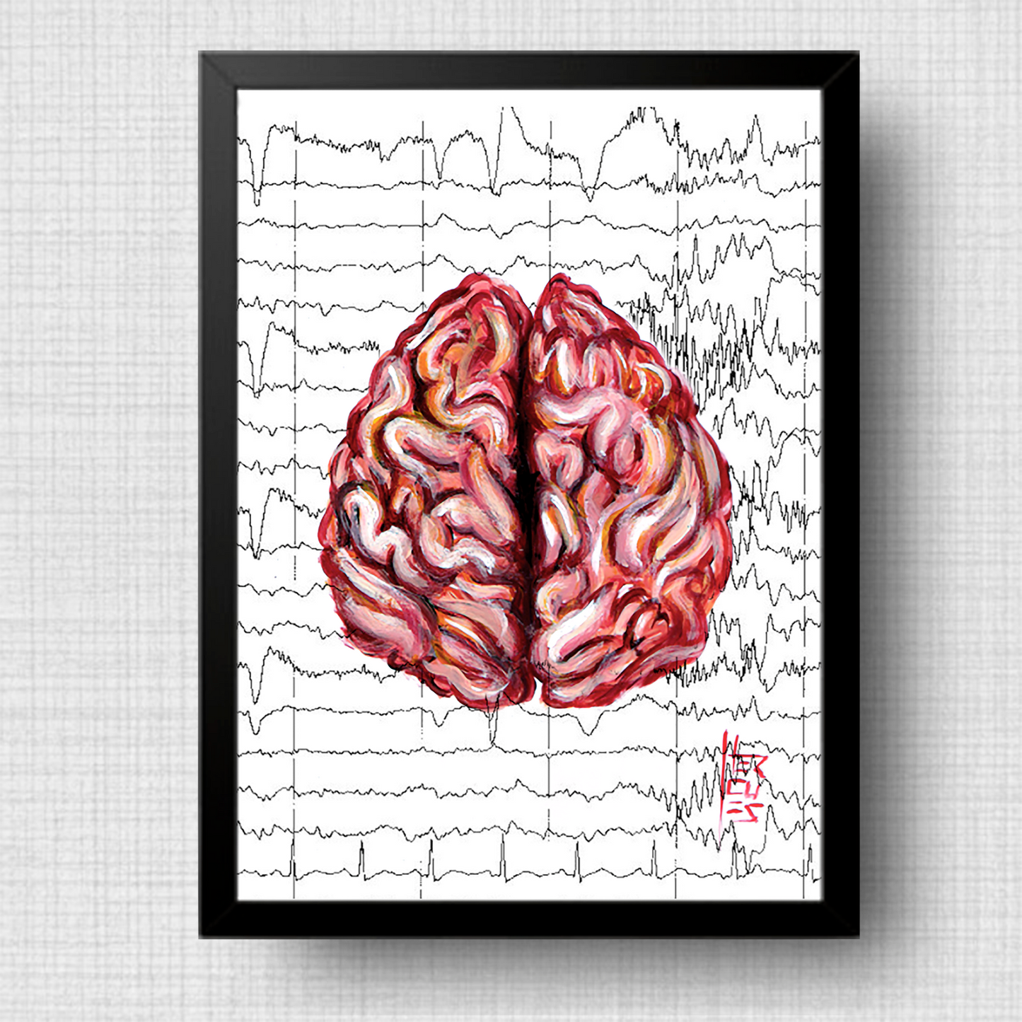 Quadro pôster anatomia cérebro fundo eletroencefalograma 2