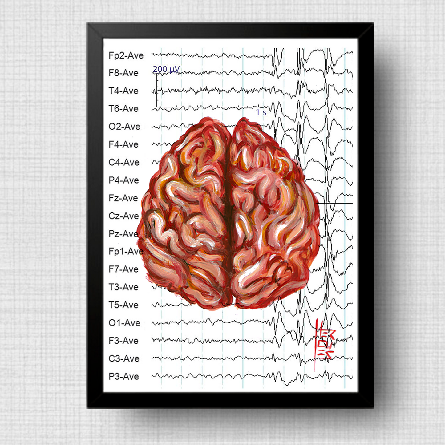 Quadro pôster anatomia cérebro fundo eletroencefalograma 1