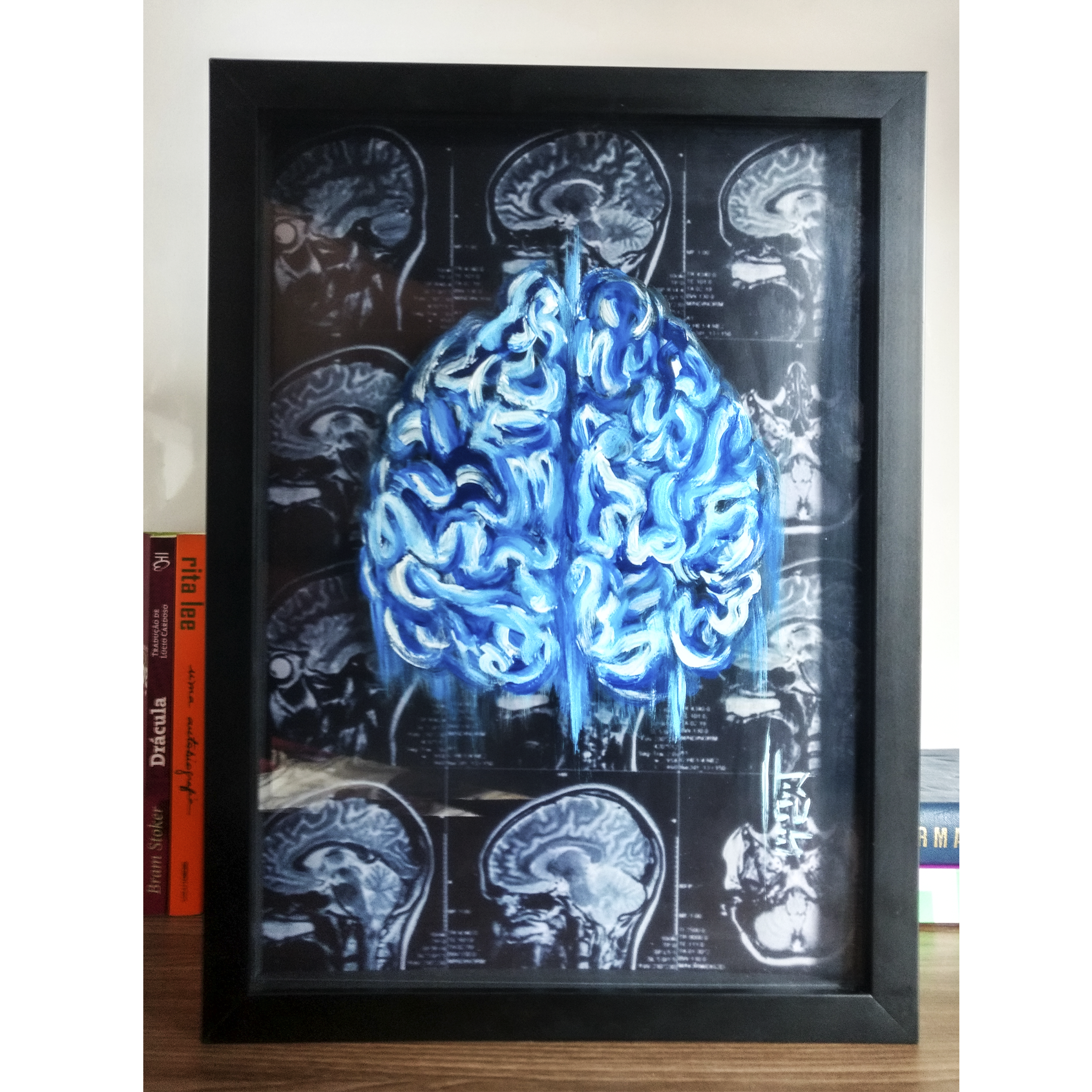 Quadro Decorativo Anatomia – Neurologia: Cérebro com Fundo de Tomografia™