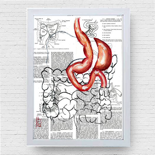 Quadro pôster anatomia: Estomago sleeve gástrico